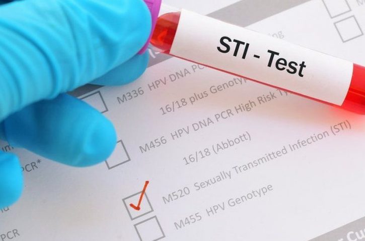 Why opt for an STD Test