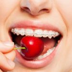 Foods that Can Harm Your Teeth