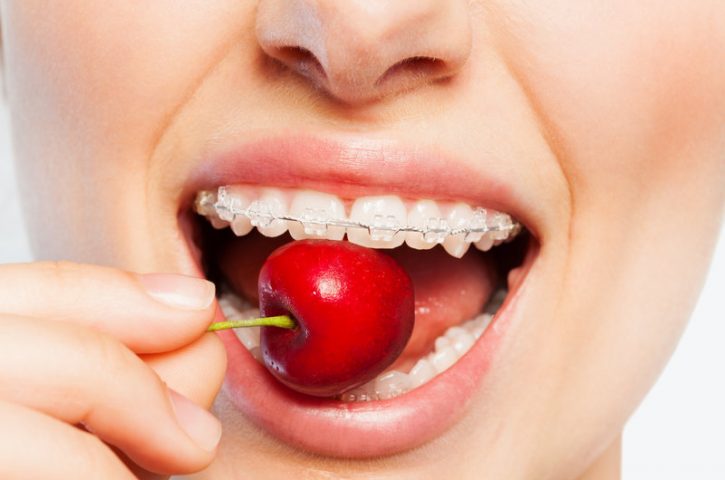 Foods that Can Harm Your Teeth